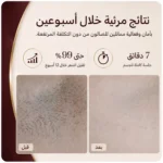 جهاز SmoothSkin Pure Switch IPL لإزالة الشعر بتقنية 3 في 1 - الصورة 11