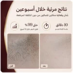 جهاز SmoothSkin Pure Fit V2 لإزالة الشعر بتقنية IPL - الصورة 8